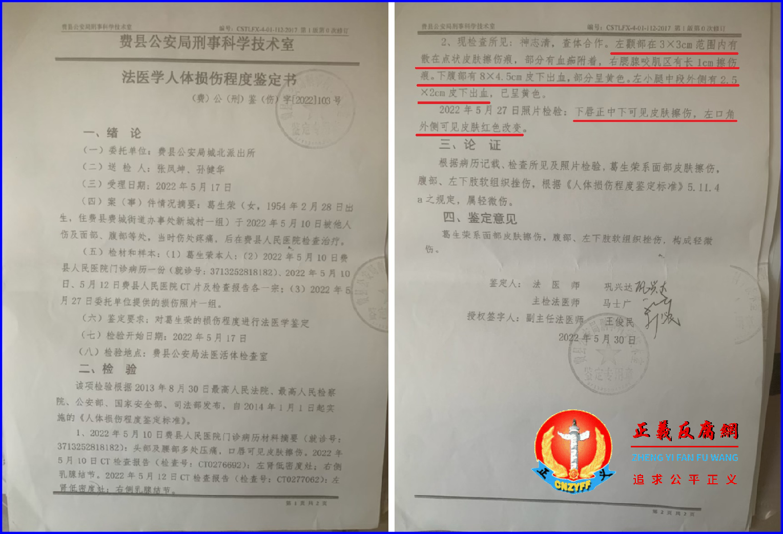 2022年5月30日，费县公安局刑事科学技术室（法医学人体损伤程度签定书），（费）公（刑）鉴（伤）字〔2022〕103号，葛生荣鉴定为轻微伤。.png